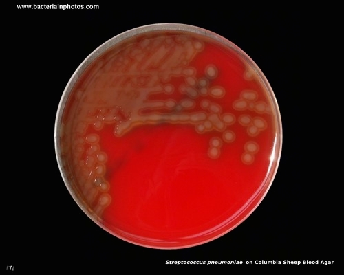 pneumococci on blood agar